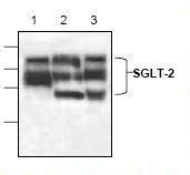 Western blot of SLC5A2 / SGLT2 antibody LS-C48629.