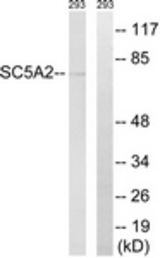 Western blot of extracts from 293 cells, using SLC5A2 Antibody. The lane on the right is treated with the synthesized peptide.