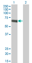Western Blot analysis of SLC5A2 expression in transfected 293T cell line by SLC5A2 monoclonal antibody (M01), clone 3G8.Lane 1: SLC5A2 transfected lysate(72.9 KDa).Lane 2: Non-transfected lysate.