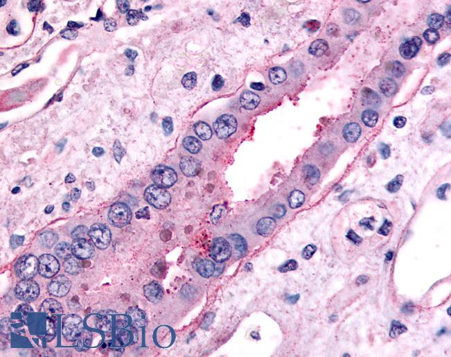 Anti-SLC5A2 antibody LS-A2810 IHC of human kidney, collecting duct. Immunohistochemistry of formalin-fixed, paraffin-embedded tissue after heat-induced antigen retrieval.