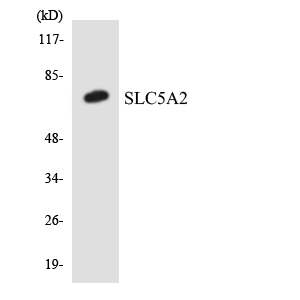 Western blot of the lysates from Jurkat cells using SLC5A2 antibody.