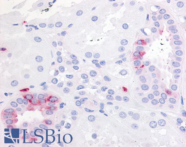 Anti-EP2 antibody LS-A4202 IHC of human kidney. Immunohistochemistry of formalin-fixed, paraffin-embedded tissue after heat-induced antigen retrieval.