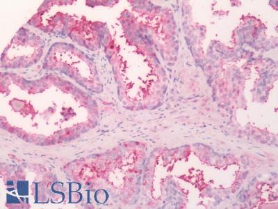 Human Prostate: Formalin-Fixed, Paraffin-Embedded (FFPE)