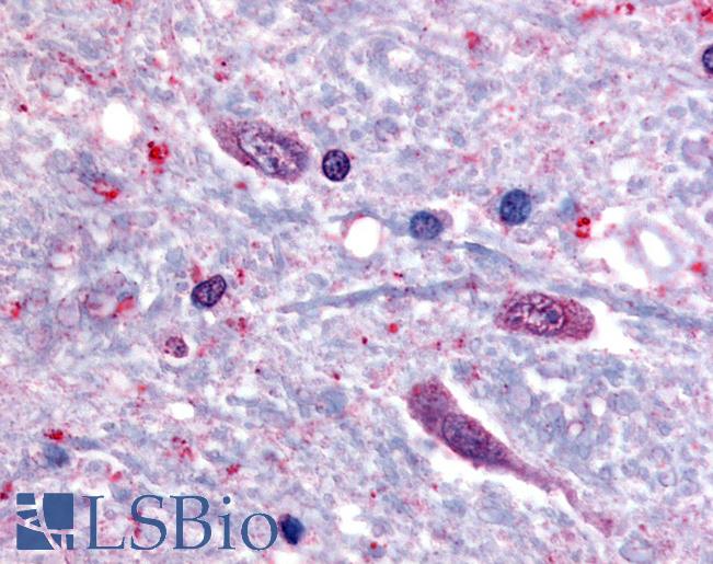 Anti-SLC5A3 antibody LS-A2816 IHC of human spinal cord. Immunohistochemistry of formalin-fixed, paraffin-embedded tissue after heat-induced antigen retrieval.