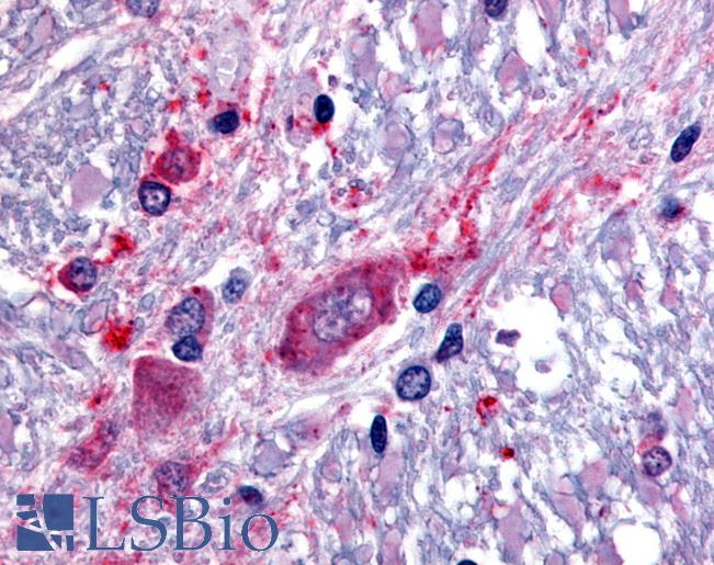 Anti-SLC5A3 antibody LS-A2760 IHC of human spinal cord. Immunohistochemistry of formalin-fixed, paraffin-embedded tissue after heat-induced antigen retrieval.