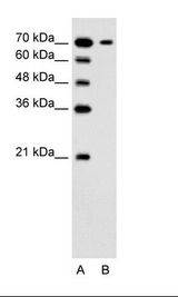 A: Marker, B: Jurkat Cell Lysate