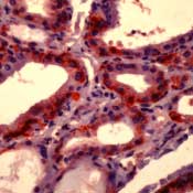 Formalin-fixed, paraffin-embedded human thyroid gland stained with peroxidase-conjugate and AEC chromogen. Note cytoplasmic staining of follicular epithelium.