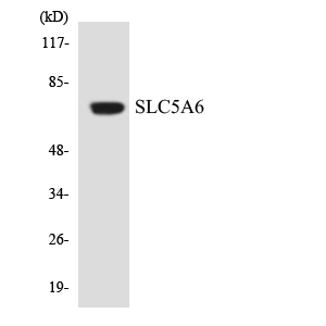 Western blot of the lysates from COLO205 cells using SLC5A6 antibody.
