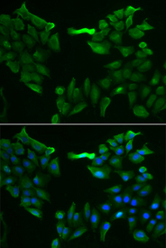 Immunofluorescence analysis of HeLa cell using SLC5A6 antibody. Blue: DAPI for nuclear staining.