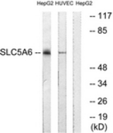 Western blot of extracts from HepG2/HUVEC cells, using SLC5A6 Antibody. The lane on the right is treated with the synthesized peptide.