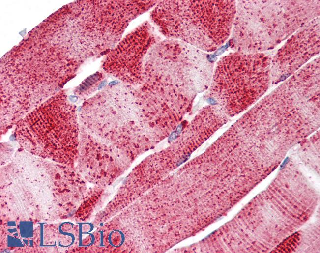 Anti-SLC5A6 antibody LS-A9767 IHC of human skeletal muscle. Immunohistochemistry of formalin-fixed, paraffin-embedded tissue after heat-induced antigen retrieval.
