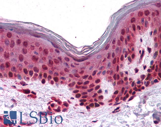 Anti-SLC5A6 antibody LS-A8754 IHC of human skin. Immunohistochemistry of formalin-fixed, paraffin-embedded tissue after heat-induced antigen retrieval.