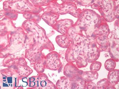 Human Placenta: Formalin-Fixed, Paraffin-Embedded (FFPE)
