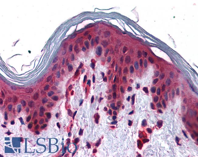 Anti-SLC5A6 antibody LS-A8757 IHC of human skin. Immunohistochemistry of formalin-fixed, paraffin-embedded tissue after heat-induced antigen retrieval.