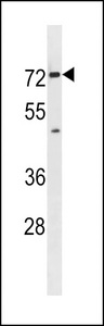 Mouse Slc5a8 Antibody western blot of mouse bladder tissue lysates (35 ug/lane). The Mouse Slc5a8 antibody detected the Mouse Slc5a8 protein (arrow).