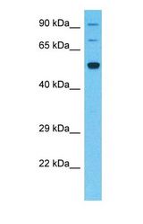 Western blot of SLC5A8 Antibody with human Fetal Kidney lysate.