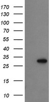 HEK293T cells were transfected with the pCMV6-ENTRY control (Left lane) or pCMV6-ENTRY PROSC (Right lane) cDNA for 48 hrs and lysed. Equivalent amounts of cell lysates (5 ug per lane) were separated by SDS-PAGE and immunoblotted with anti-PROSC.