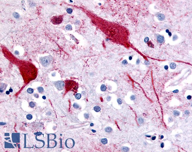 Anti-SLC5A9 antibody LS-A2788 IHC of human brain, cortex. Immunohistochemistry of formalin-fixed, paraffin-embedded tissue after heat-induced antigen retrieval.