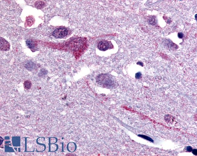 Anti-SLC5A9 antibody LS-A2787 IHC of human brain, cortex. Immunohistochemistry of formalin-fixed, paraffin-embedded tissue after heat-induced antigen retrieval.
