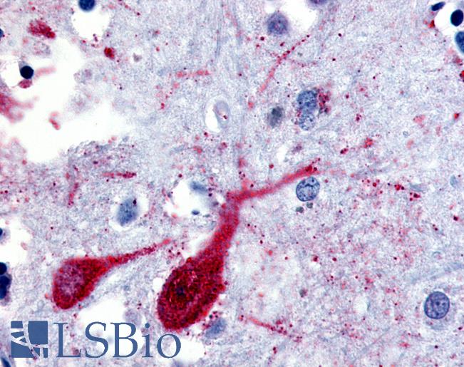 Anti-SLC5A9 antibody LS-A2920 IHC of human brain, cortex. Immunohistochemistry of formalin-fixed, paraffin-embedded tissue after heat-induced antigen retrieval.