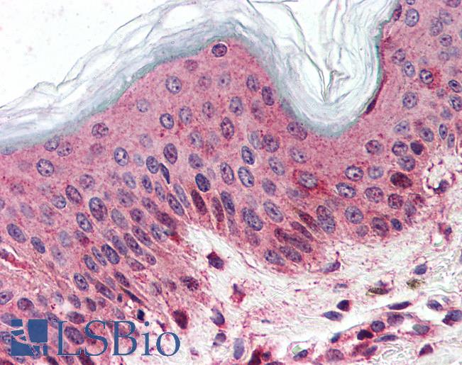 Anti-SLC5A9 antibody LS-A2790 IHC of human skin. Immunohistochemistry of formalin-fixed, paraffin-embedded tissue after heat-induced antigen retrieval.