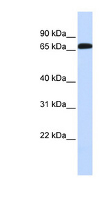 SLC6A1 / GAT-1 antibody LS-C110826 Western blot of Fetal Liver lysate.