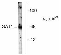 Western blot of rat hippocampal homogenate showing specific immunolabeling of the ~67k GAT-1 protein.