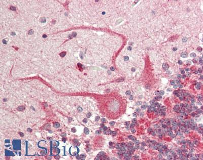 Human Brain, Cerebellum: Formalin-Fixed, Paraffin-Embedded (FFPE)