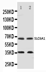 WB of SLC6A1 / GAT-1 antibody. All lanes: Anti-SLC6A1 at 0.5ug/ml. Lane 1: Rat Brain Tissue Lysate at 40ug. Lane 2: Mouse Brain Tissue Lysate at 40ug. Predicted bind size: 67KD. Observed bind size: 67KD.
