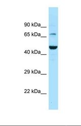 Western blot of Human PANC1 . SLC6A11 antibody dilution 1.0 ug/ml.