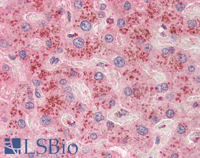 Anti-SLC6A12 / BGT-1 antibody IHC staining of human liver. Immunohistochemistry of formalin-fixed, paraffin-embedded tissue after heat-induced antigen retrieval. Antibody LS-B10391 concentration 10 ug/ml.