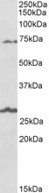 SLC6A12 antibody (1 ug/ml) staining of Human Olfactory bulb lysate (35 ug protein in RIPA buffer). Primary incubation was 1 hour. Detected by chemiluminescence.