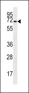 SLC6A14 Antibody western blot of HL-60 cell line lysates (35 ug/lane). The SLC6A14 antibody detected the SLC6A14 protein (arrow).