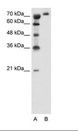 A: Marker, B: Jurkat Cell Lysate
