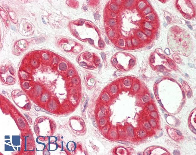 Human Kidney: Formalin-Fixed, Paraffin-Embedded (FFPE)