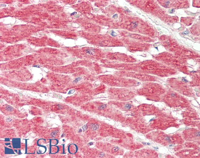 Human Heart: Formalin-Fixed, Paraffin-Embedded (FFPE)