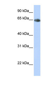 SLC6A2 antibody LS-B11890 Western blot of Fetal Heart lysate.