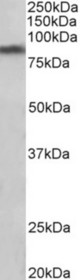 SLC6A3 antibody (1 ug/ml) staining of Human Substantia nigra lysate (35 ug protein in RIPA buffer). Primary incubation was 1 hour. Detected by chemiluminescence.