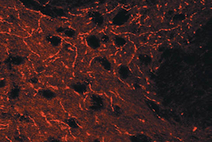 IHC: Guinea Pig anti-Serotonin Transporter (LS-C152826).