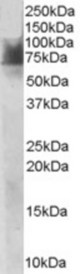 Antibody staining (1 ug/ml) of Human Duodenum lysate (RIPA buffer, 30 ug total protein per lane). Primary incubated for 1 hour. Detected by Western blot of chemiluminescence.