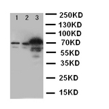 WB of SLC6A4 / SERT antibody. Lane 1: U87 Cell Lysate. Lane 2: HELA Cell Lysate. Lane 3: JURKAT Cell Lysate.