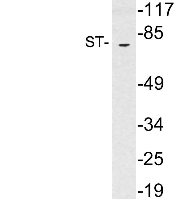 Western blot of extracts from brain tissue , using ST antibody.