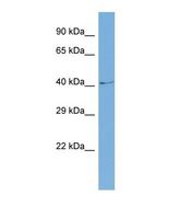 Western blot of Human COLO205. SLC6A5 antibody dilution 1.0 ug/ml.