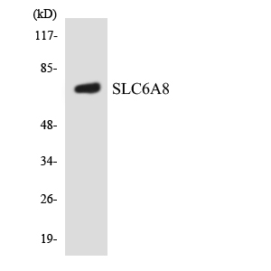 Western blot of the lysates from HUVEC cells using SLC6A8 antibody.