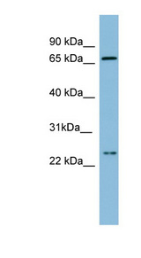 SLC6A8 antibody LS-C107563 Western blot of Fetal Small Intestine lysate.