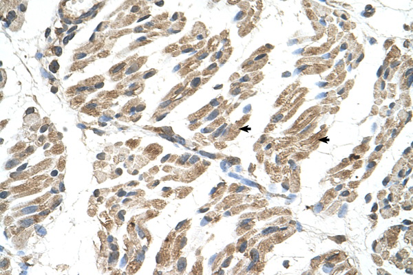 SLC6A8 antibody LS-C40375 IHC of formalin-fixed, paraffin-embedded human Muscle. Positive label: Skeletal muscle cells indicated with arrows. Antibody concentration 4-8 ug/ml. Magnification 400X.