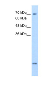 SLC6A8 antibody LS-C40375 Western blot of MDA-MB-435S cell lysate.