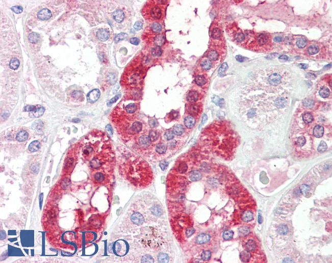 Anti-SLC6A8 antibody IHC staining of human kidney. Immunohistochemistry of formalin-fixed, paraffin-embedded tissue after heat-induced antigen retrieval. Antibody LS-B9535 concentration 5 ug/ml.