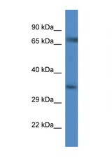 SLC6A9 / GLYT1 antibody LS-C135114 Western blot of Mouse Spleen lysate. Antibody concentration 1 ug/ml.