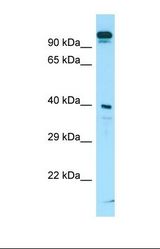 Western blot of Human ACHN. SLC7A10 antibody dilution 1.0 ug/ml.